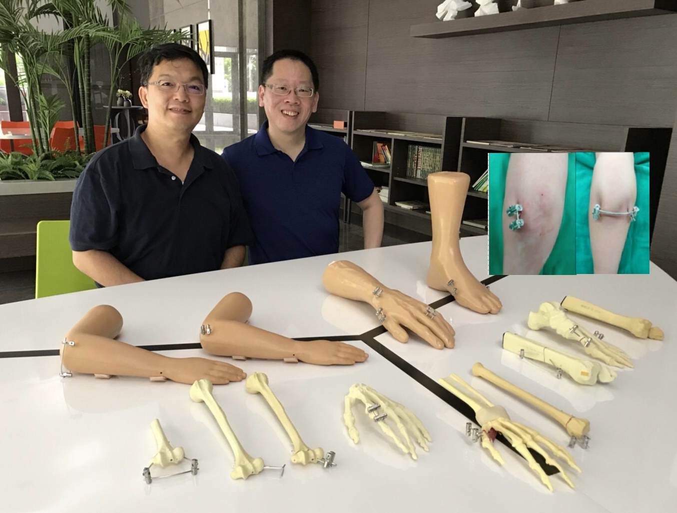胡志中老師(左1)與林口長庚醫院醫師團隊合作研發 「四肢骨折手術與復健之克氏鋼釘固定技術」榮獲第18屆「國家新創獎」